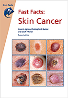 Fast Facts: Skin Cancer