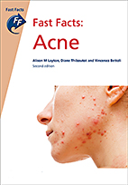 Fast Facts: Acne