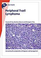 Fast Facts: Peripheral T-cell Lymphoma