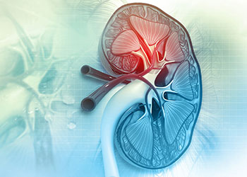 Nephrology Viewpoints Kachel