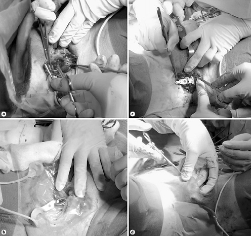  Key points of the surgical technique. a Bulbar urethra is elevated from the underlying corpora cavernosa. b Urethral circumference is measured to guide the choice of the cuff diameter. c A cuff with appropriate size is positioned around the urethra. d The pump is placed in a scrotal superficial dartos pouch.