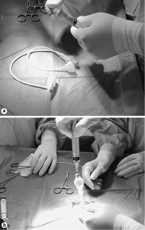  Phases of AUS preparation. a The prosthesis is prepared for the implantation. b Saline solution is used to fill the prosthesis (13cc for VICTO® and 20cc for VICTOplus®).