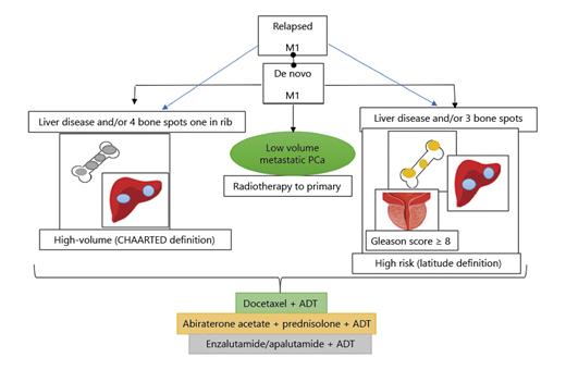 Fig. 3. Clinical drivers of decision-making. PCa, prostate cancer; M1, metastatic; ADT, androgen deprivation therapy.