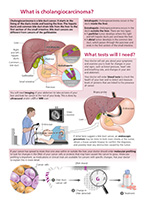 Preview of Summary Sheet 'What is Cholangiocarcinoma?'