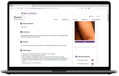 Image DermaCompass on screen from laptop