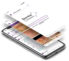 Image DermaCompass on screen from mobile