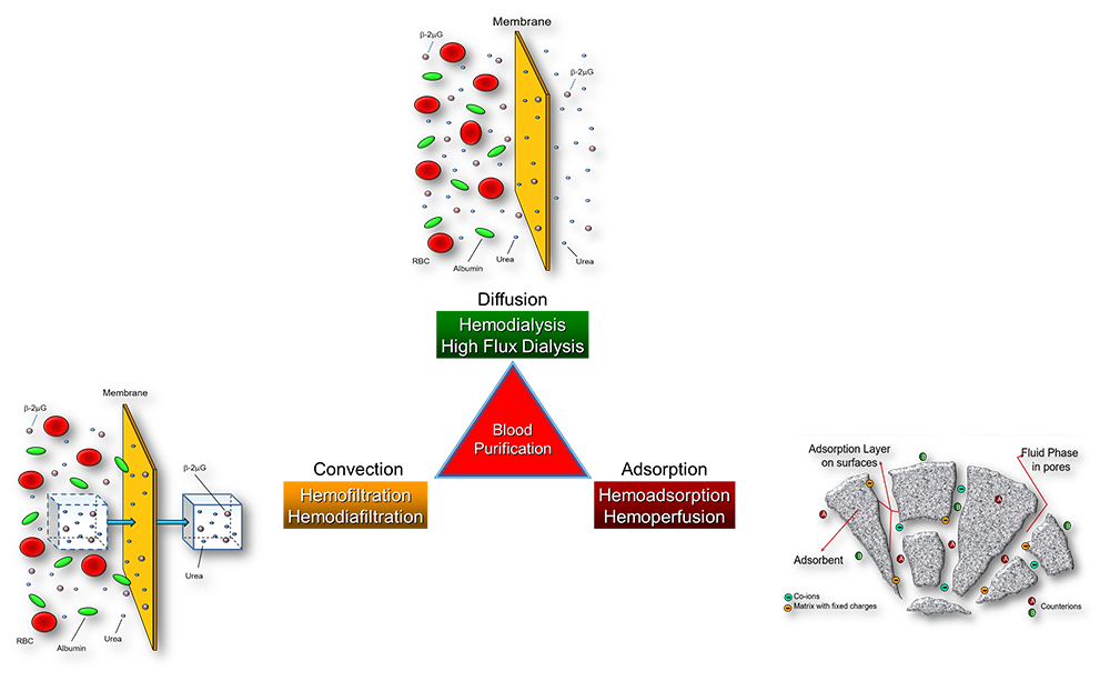 Adsorption-in-Extracorporeal-Therapies-Image