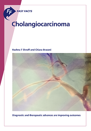 Fast Facts: Cholangiocarcinoma