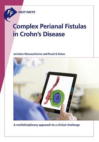 Fast Facts: Complex Perianal Fistulas in Crohn's Disease